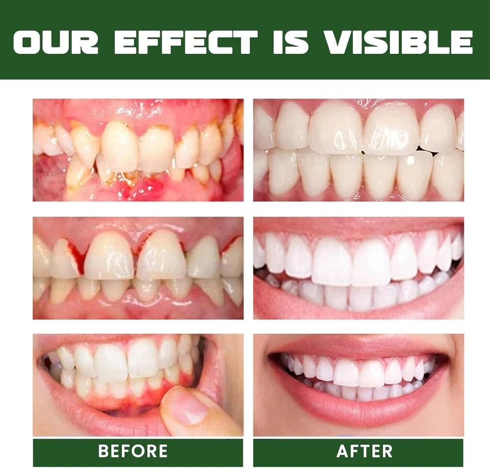 Gum Regrowth Drops,Gum Repair for Receding Gums,Gum Relief Drops,Receding New UK