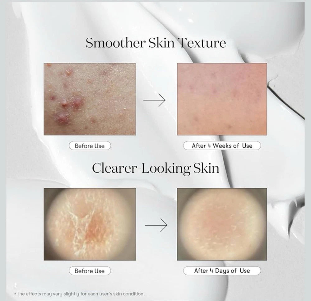 VT Cosmetics - CICA X HYALON - Reedle Shot 700 (570,000) 30mL /1oz