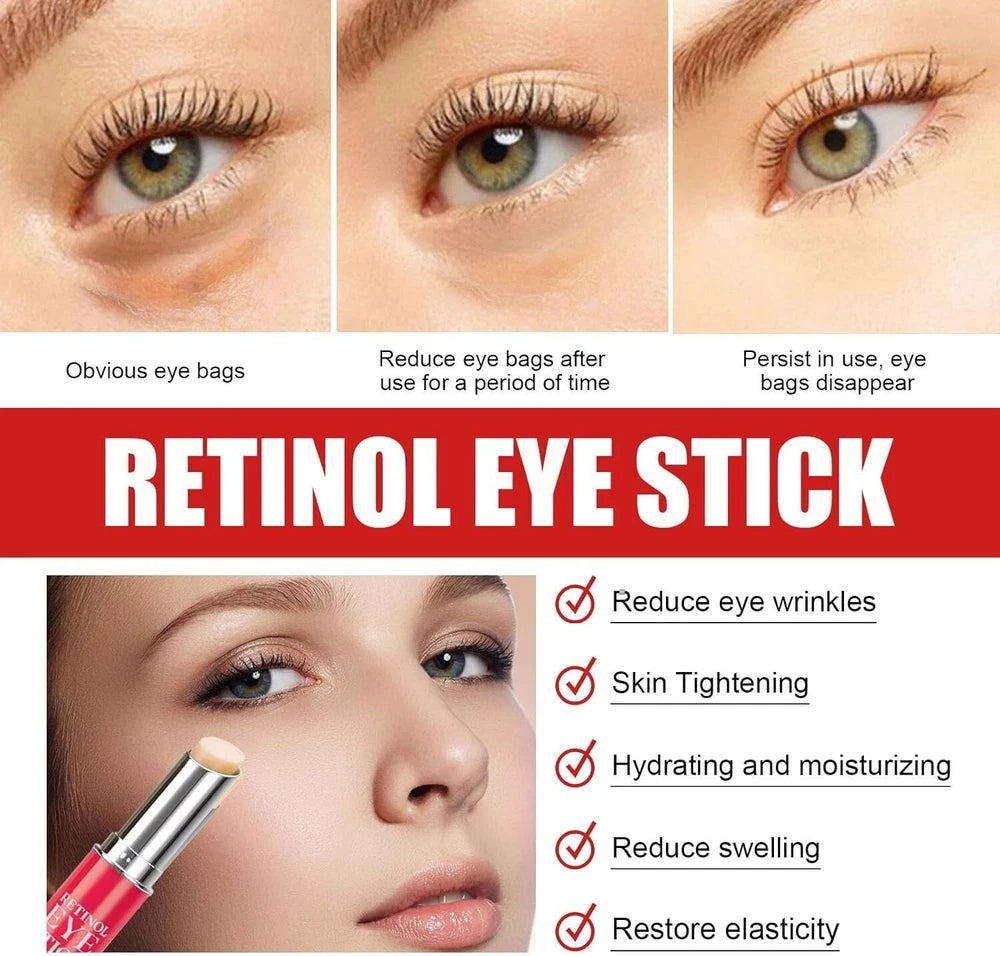 Retinol Eye Stick - Anti Wrinkle Eye Cream For Puffy Eyes, Dark Circles, Eye UK