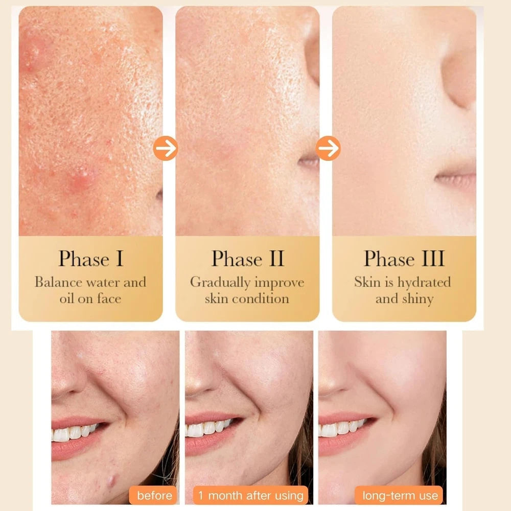 Turmeric Face Cream, Brightening Face Cream for Radiant&Glowing Skin,Dark Spot C