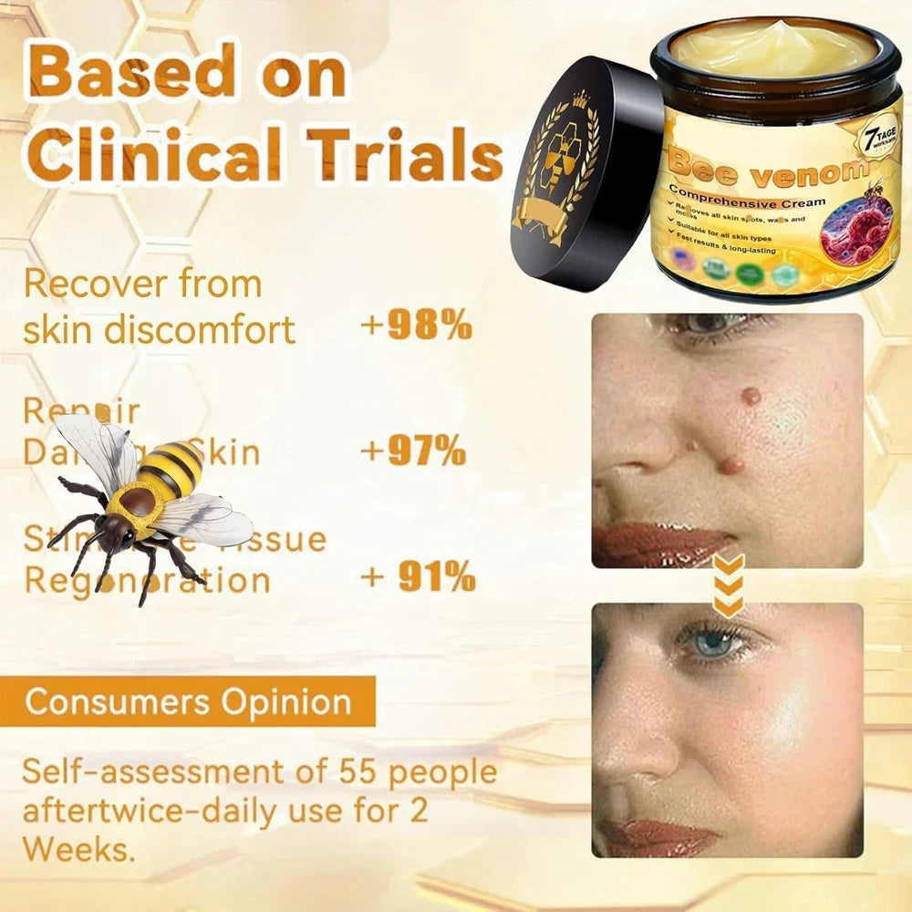 2Pcs Bee Venom Cream, Bee Venom Skin Treatment Cream, Bee Venom Wrinkle Removal