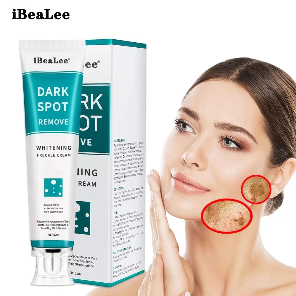 Whitening Freckle Cream Remove Dark Spots Anti-Freckle Cream Niacinamide Fade UK