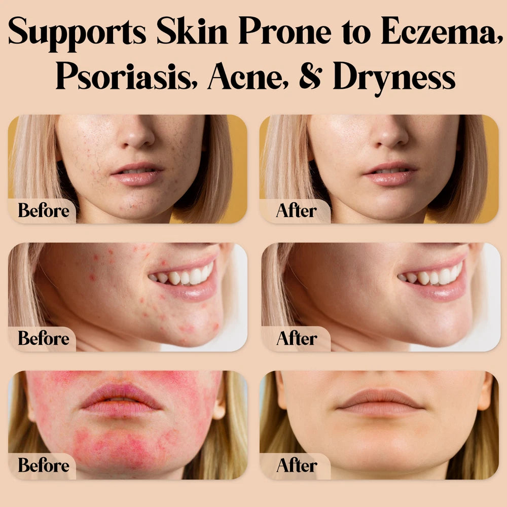 Natural Grass-Fed Beef Tallow Balm Skincare with Jojoba Oil, Honey & Beeswax UK