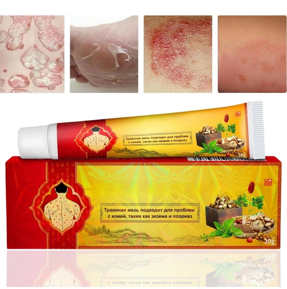 3pcs Antifungal Cream,Cream for Itchy Skin,Antifungal Cream for Skin,Itchy Skin