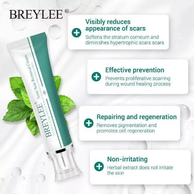 Breylee Acne Scar Removal Cream 30G Face Cream Skin Repair Skin Care Scar Acne
