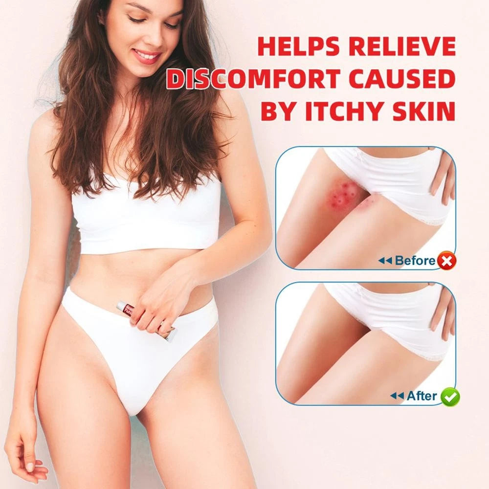 Sumifun Pubic Lice Anti-itch Cream -new