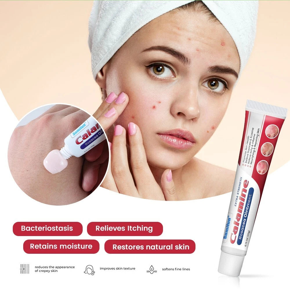 20g New Rosacea Ointment Treat Red Nose Acne Cream Pimple Scar Repair Skin Care