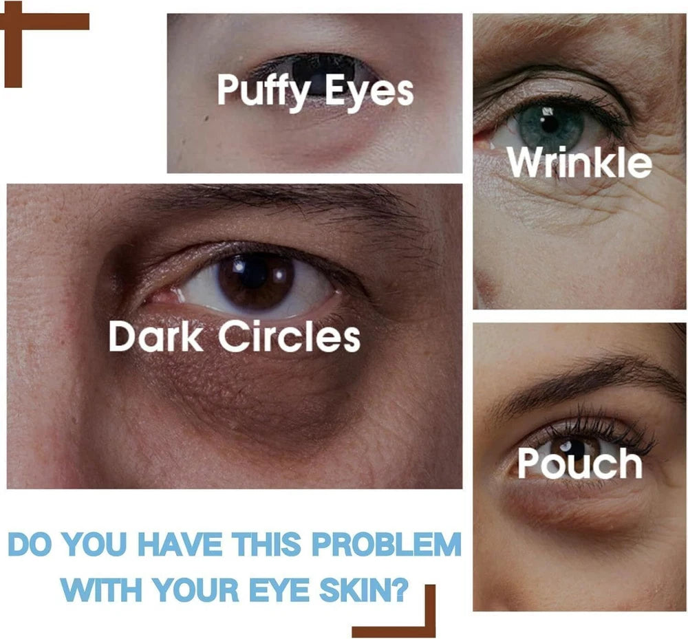 Anti Aging  Eye Cream for Dark Circles & Wrinkles – Anti-Aging, Puffiness Relief