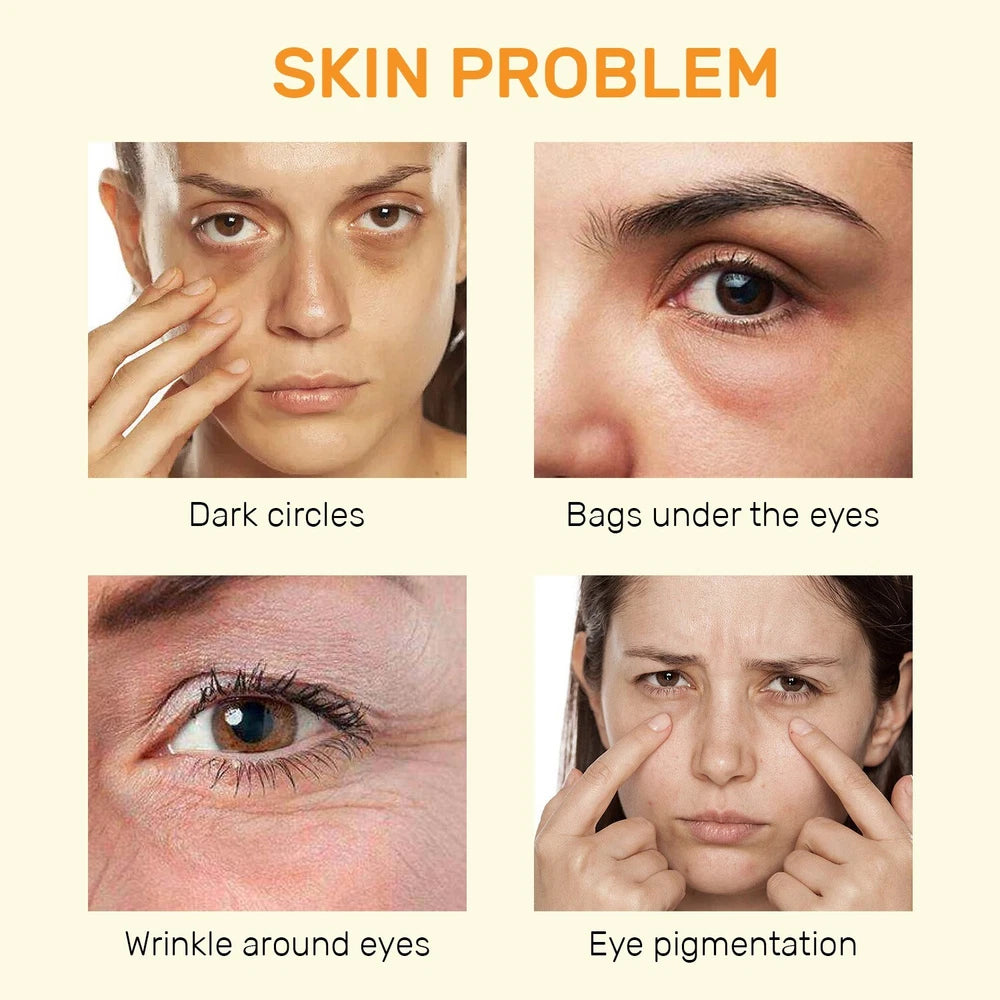 Vitamin C Eye Cream - Brighten, Anti-Aging, Dark Circles & Puffiness Treatment