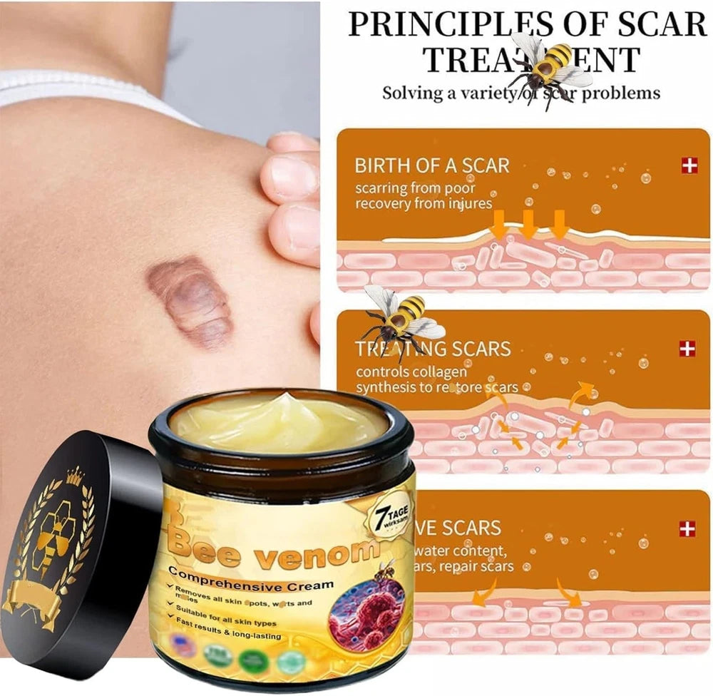 2Pcs Bee Venom Cream, Bee Venom Skin Treatment Cream, Bee Venom Wrinkle Removal