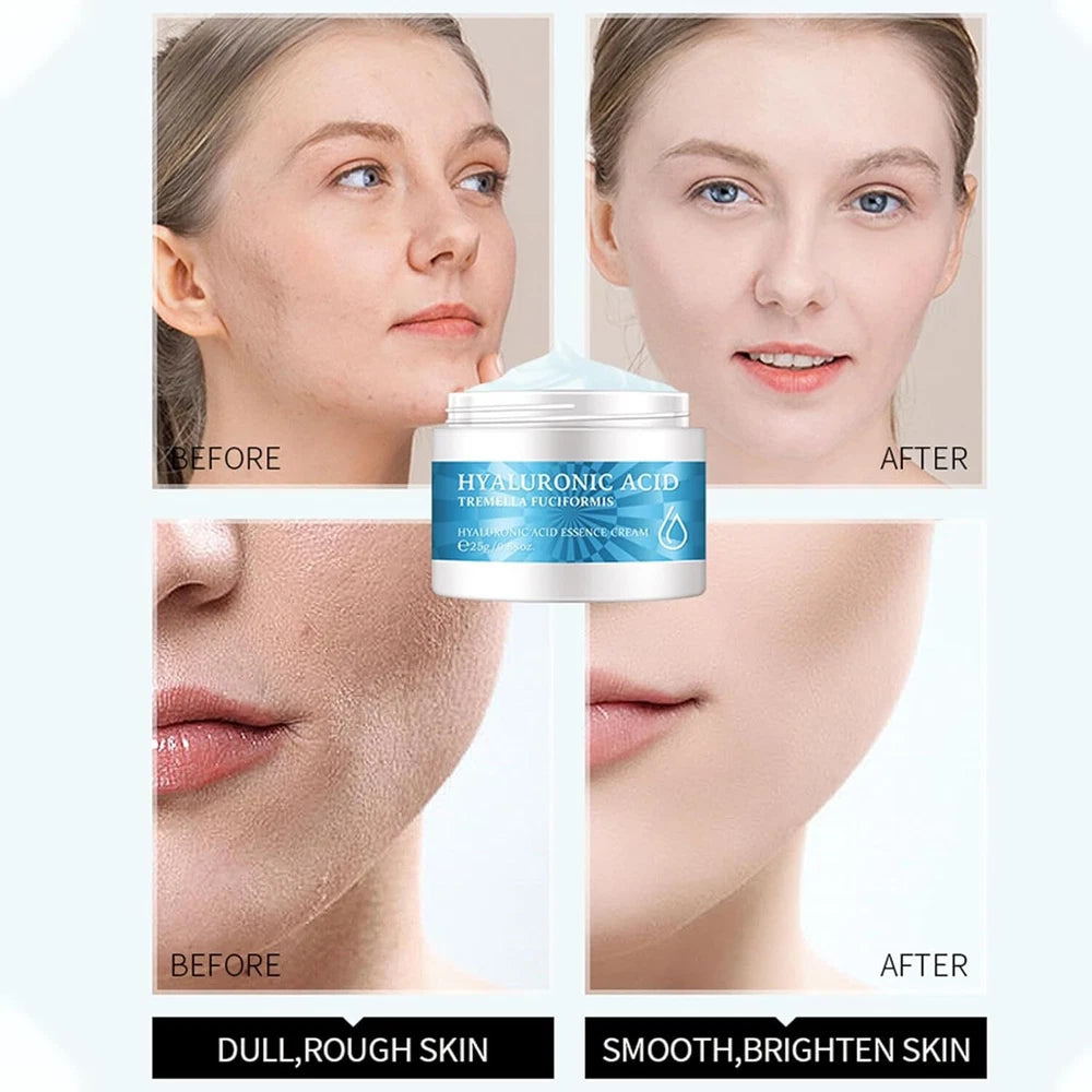 Collagen Face Lift Cream Anti Ageing Wrinkles Hyaluronic Acid Face Moisturiser