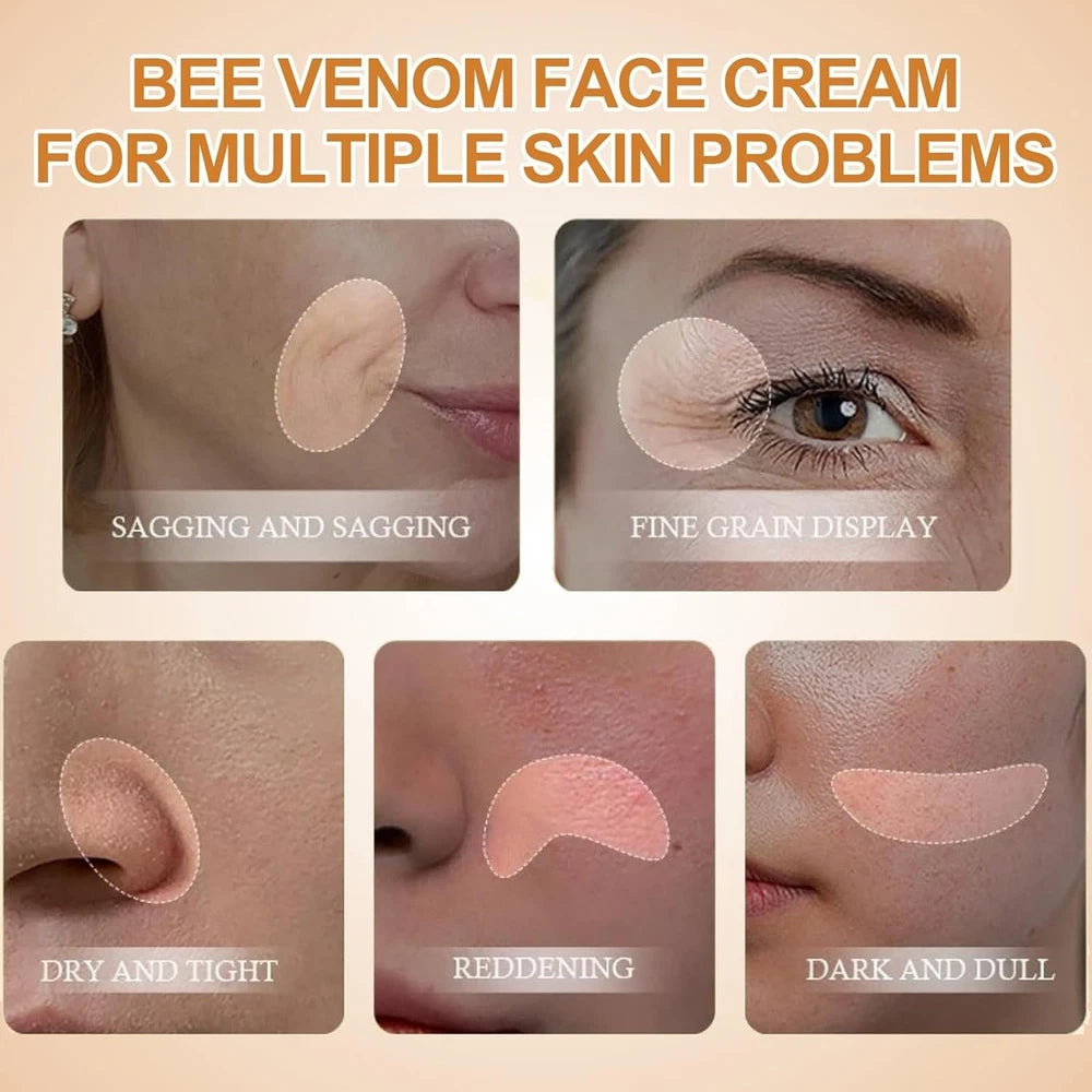 2PCS Bee Venom Cream,Bee Venom Wrinkle Removal Cream,Anti Wrinkle Firming Multi