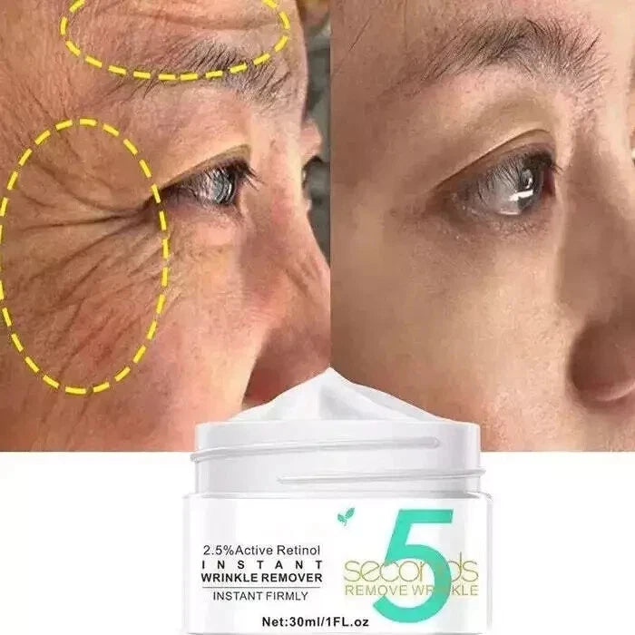 5 Seconds Wrinkle Remove Instant Face Cream Skin Tightening Anti-Aging Serum UK