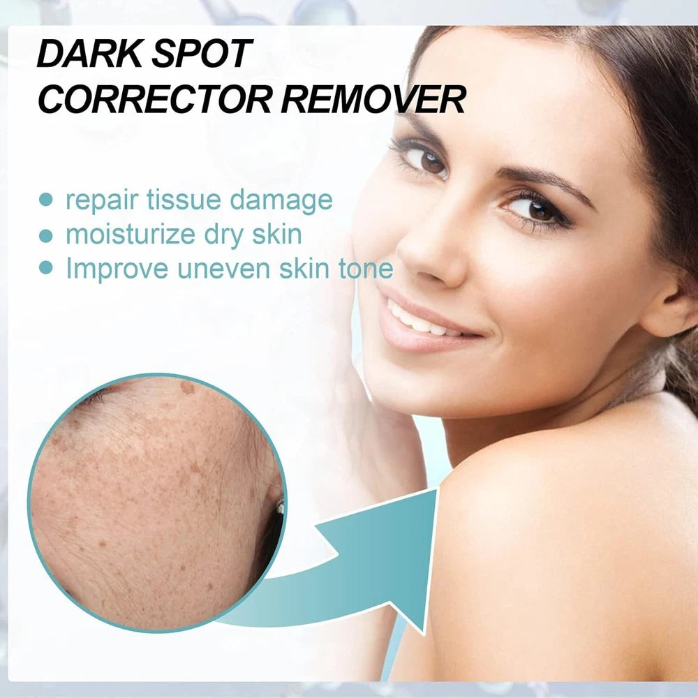 Dark Spot Remover for Face Age / Liver Spots Corrector Freckles & Skin Whitening