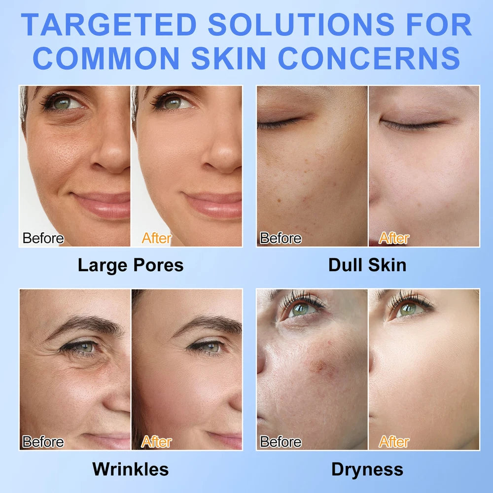 6pcs Overnight Korean Bio-Collagen Real Deep Face Mask _ Brightening  Hydrating