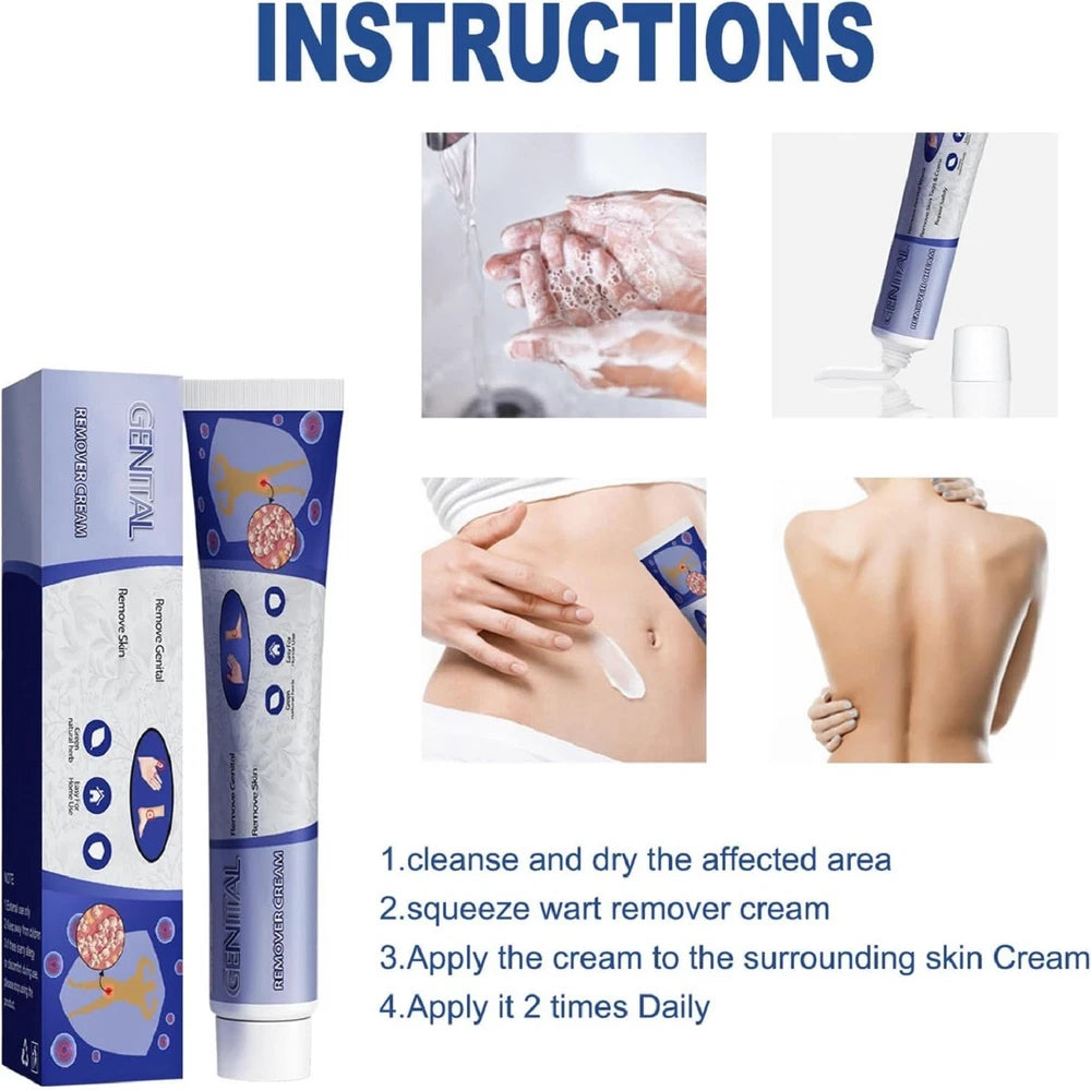 STRONG SKIN TAG REMOVER Cream NATURAL TREATMENT MOLES WARTS and TAGS