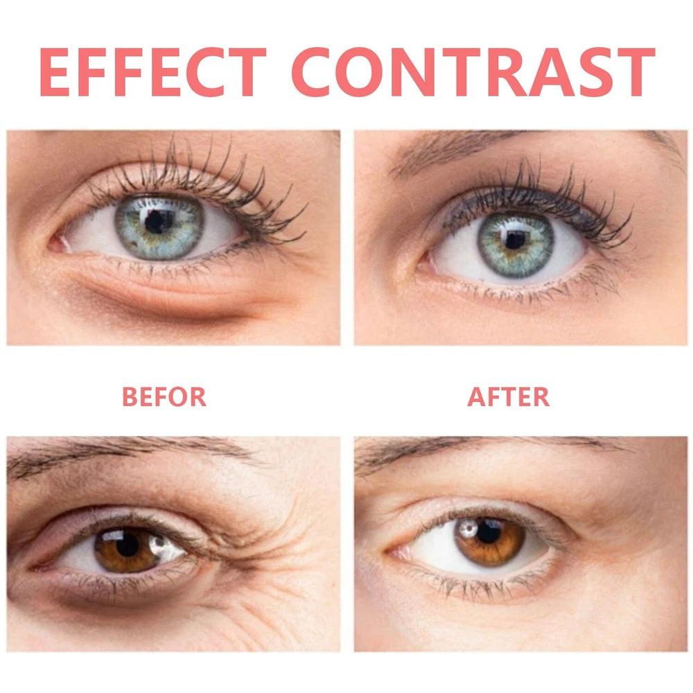 Retinol Eye Cream Stick Remove Wrinkle Eye Bags Dark Circles Anti Puffiness Firm