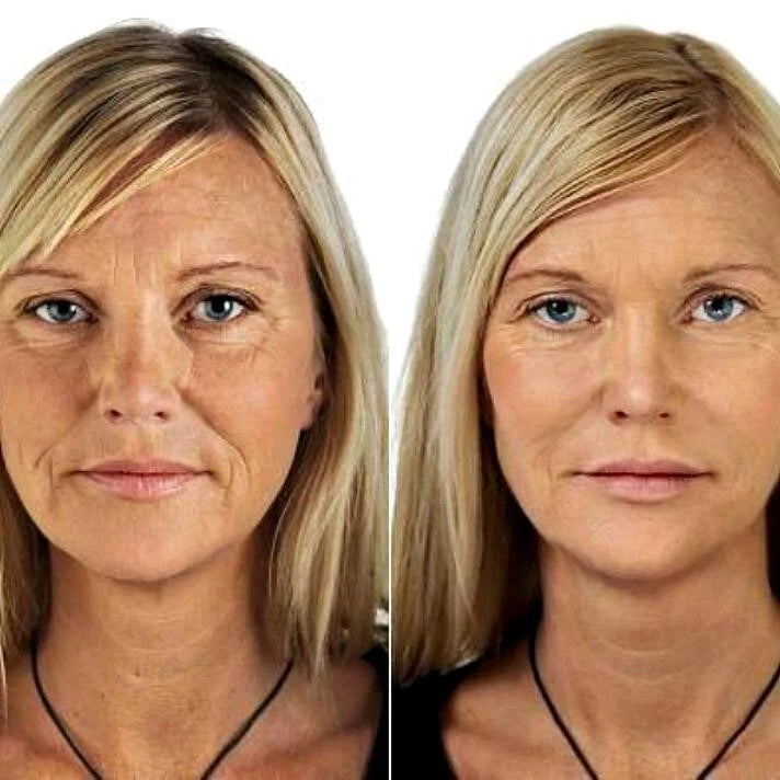 Retinol + Collagen, Hyaluronic Acid, Vitamin C AntiAging Wrinkle Serum Cream 4oz