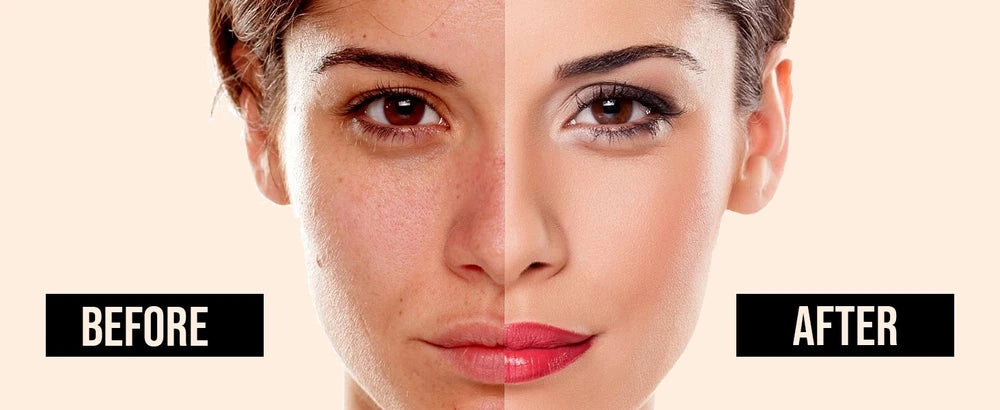 Extreme Whitening Face Cream Dark Spots Blemishes Bikini Under Arms Full Body