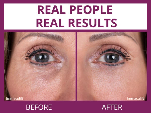 INSTANT WRINKLE Eye Tightener Cream Wrinkle Remover Serum with Argireline