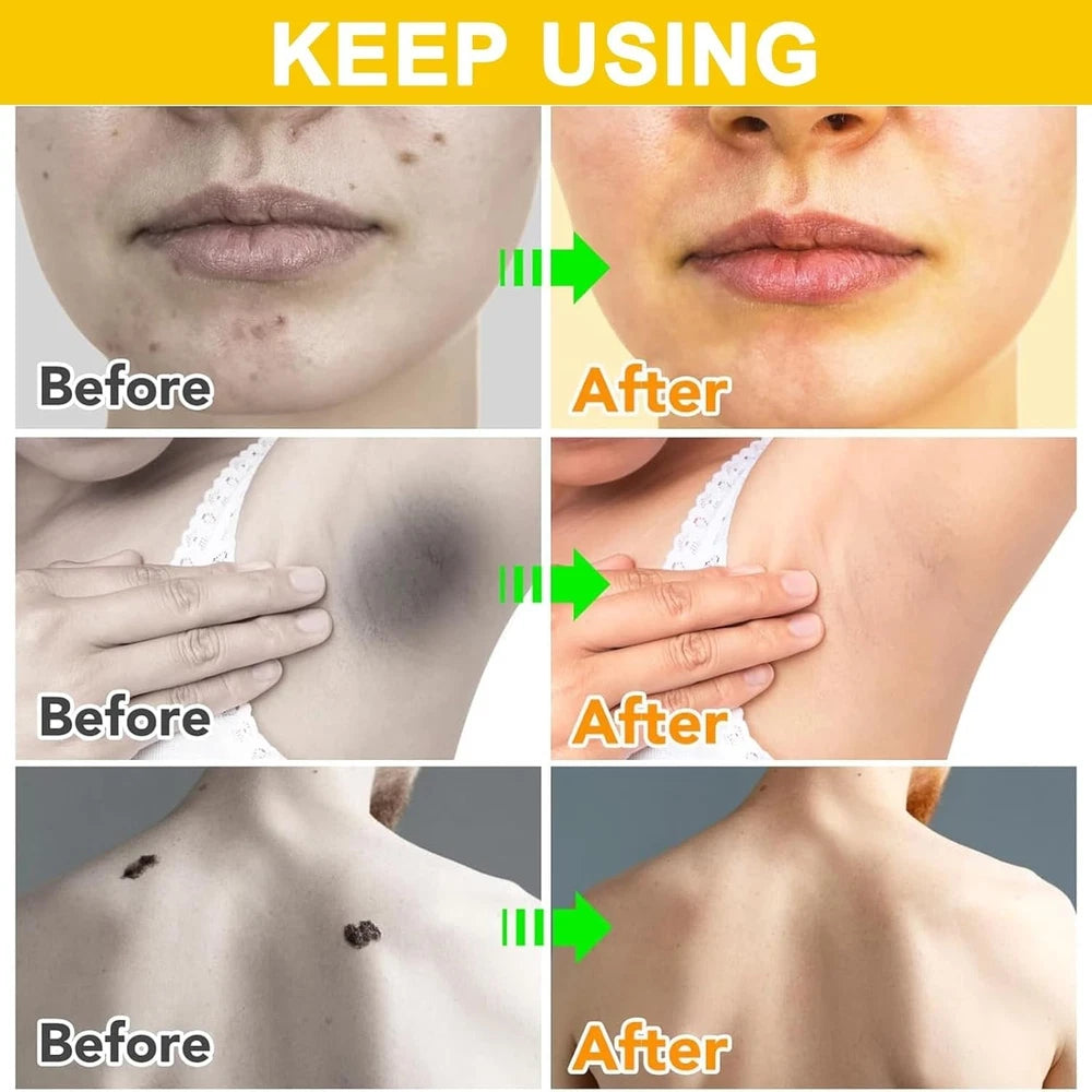 2Pcs Bee Venom Skin Treatment Cream, Bee Venom Cream, Skin Repair, Enric