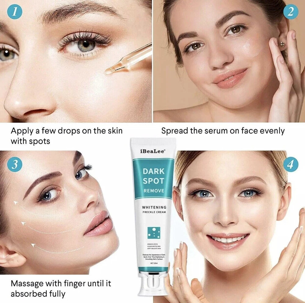iBeaLee Whitening Freckle Cream Remove Melasma Dark Spots Cream Anti-Aging 20ml