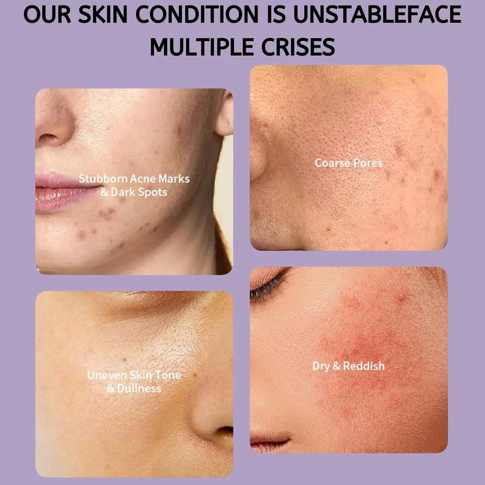 Dark Spot Skin Tone Bleaching Freckle Lightening Whitening Cream For Face Body