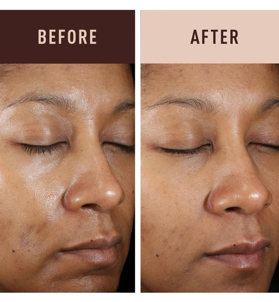 Fade Cream Pigmentation Face Cream Discoloration Skin Tone Blemish Cream 30ml