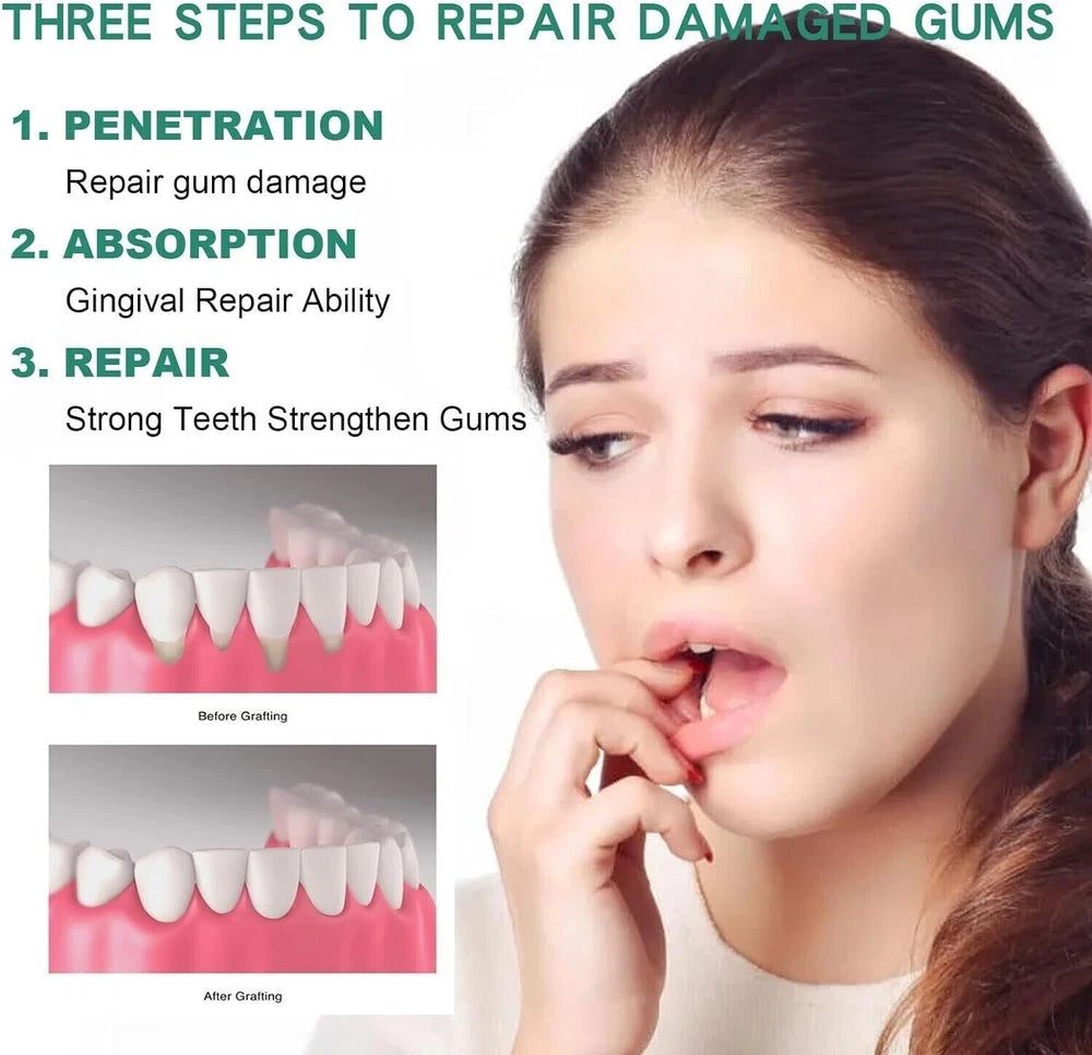Gum Regrowth Drops,Gum Repair for Receding Gums,Gum Relief Drops,Receding New UK