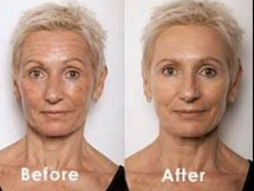 Retinol + Collagen, Hyaluronic Acid, Vitamin C AntiAging Wrinkle Serum Cream 4oz