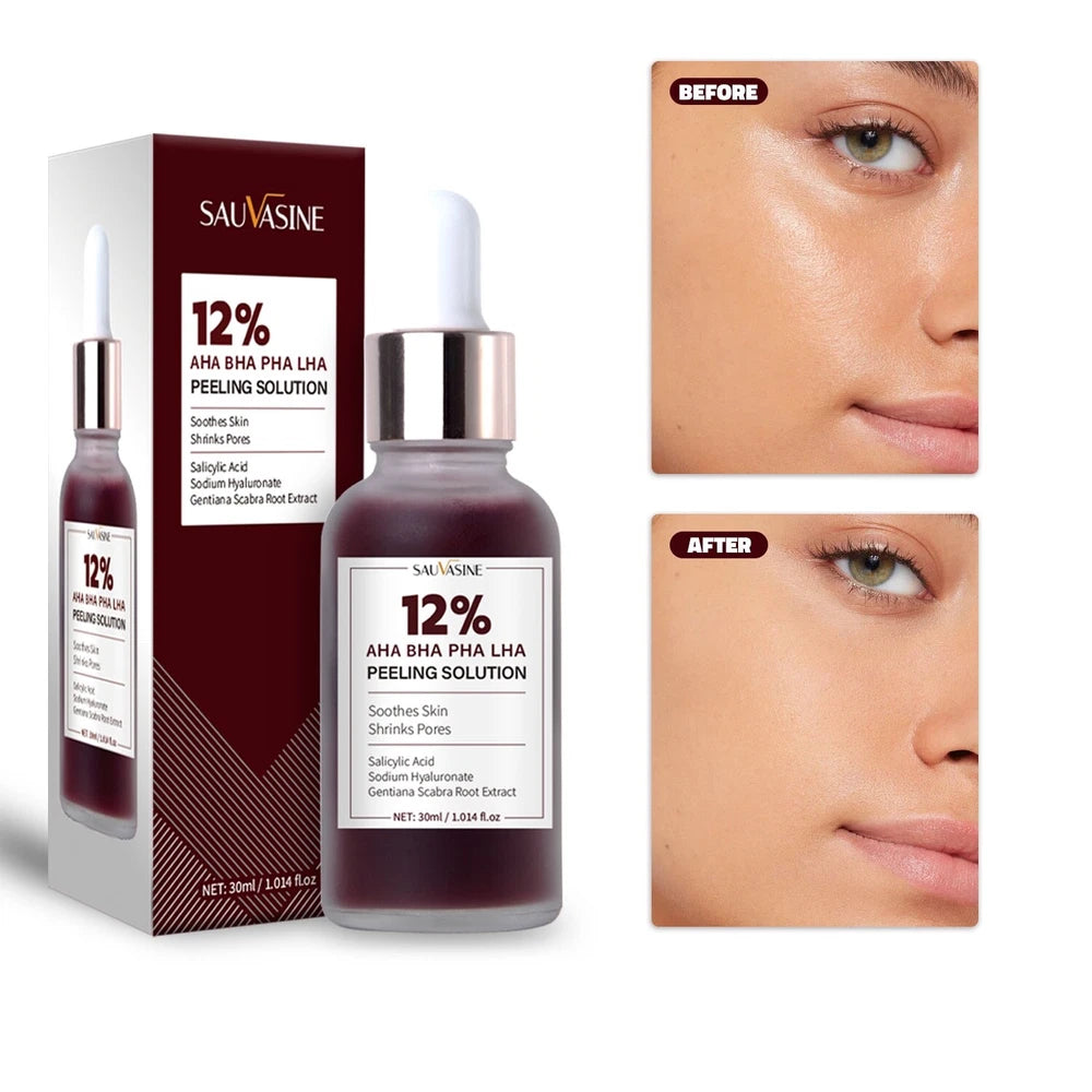 12% AHA BHA PHA LHA Peeling Solution Serum Brighen skin tone & Moisturise 30ml