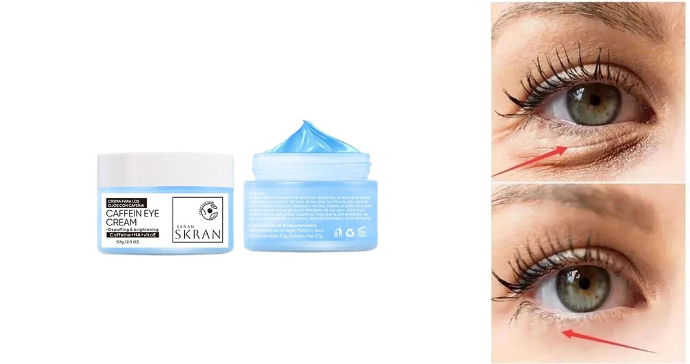 Anti Aging  Eye Cream for Dark Circles & Wrinkles – Anti-Aging, Puffiness Relief