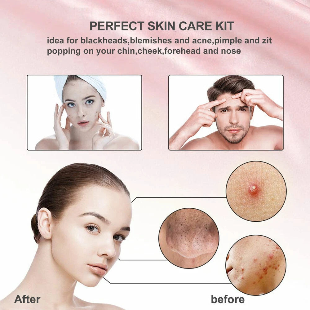 11x Blackhead Remover Tool Kit Spot Acne Pimple Comedone Extractor Comedone Box