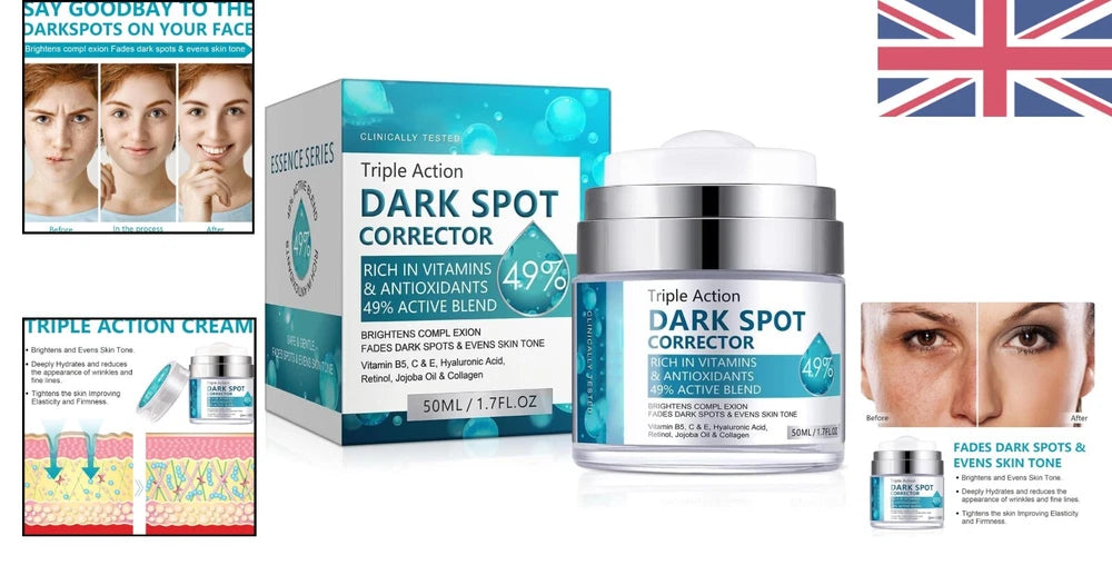 Hyperpigmentation Treatment Cream for Even Skin Tone - 50ml Dark Spot Remover