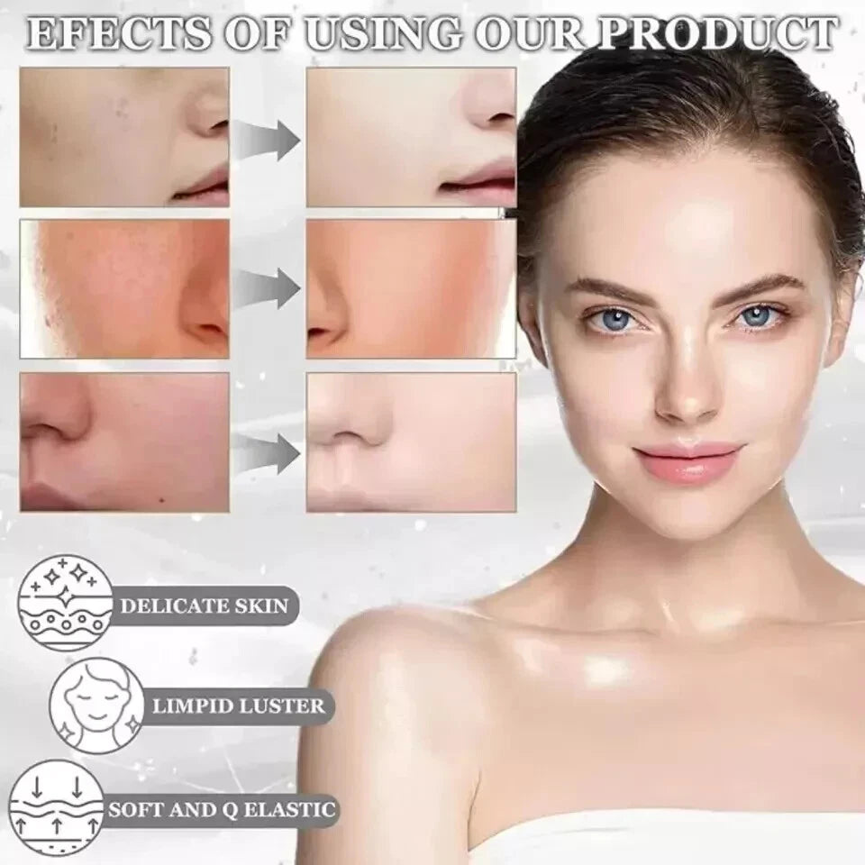 ANUA Heartleaf 70 Intense Calming Cream Skincare Moisturizer 50ml