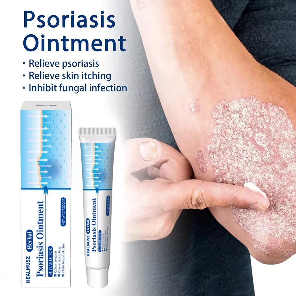 Natural Psoriasis Cream for Dermatitis Eczematoid Eczema Skin Ointment Treatment