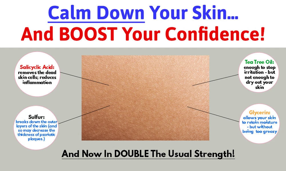 V66 MAX DOUBLE STRENGTH Psoriasis Salicylic Acid Skin Scalp Treatment Cream 50g