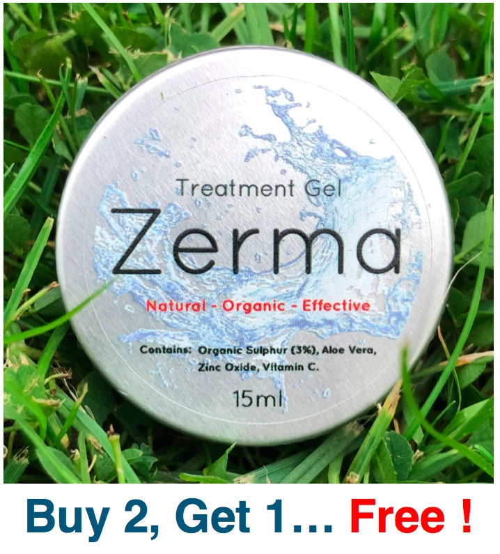 ZERMA Eczema, Psoriasis, Skin Rash Ointment Cream, Natural Treatment Gel