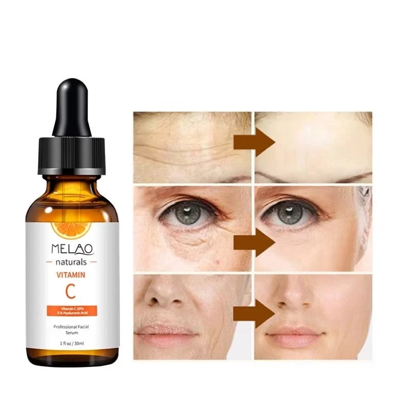 Melao Vitamin C Super Serum Retinol Hyaluronic Acid Nicotinamide Anti Aging 30ml