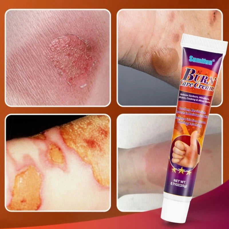 20g New Burn Scald Cream Skin Repair Anti-Infection Wound Plaster Pain Relief