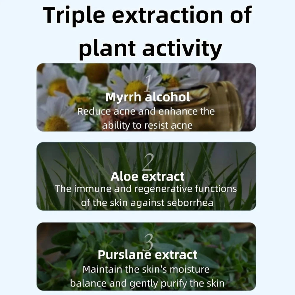 Aze-laic Acid 15% Acne Tratment Gel,15% Acid Acne Treatment Gel for Face,Azel-a