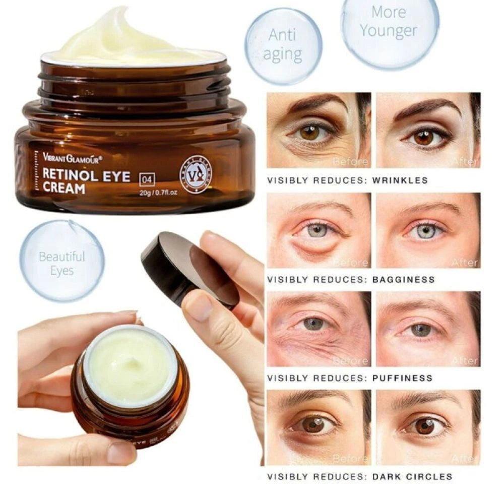 Best 100% Under Eye Cream Retinol, Remove Dark Circles Wrinkles Lines Puffy Eyes