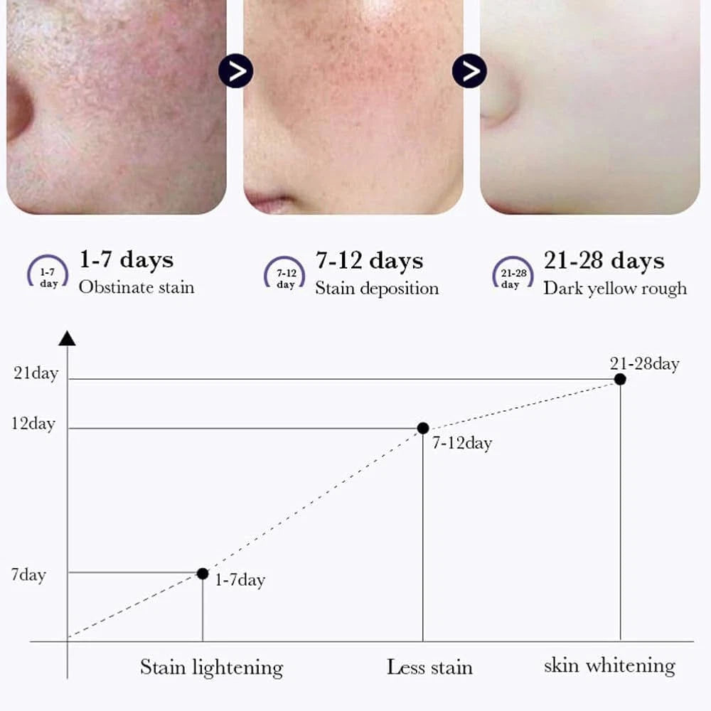 Dark Spot Melasma Hyperpigmentation Freckles Spots Removal Face Cream  Effective