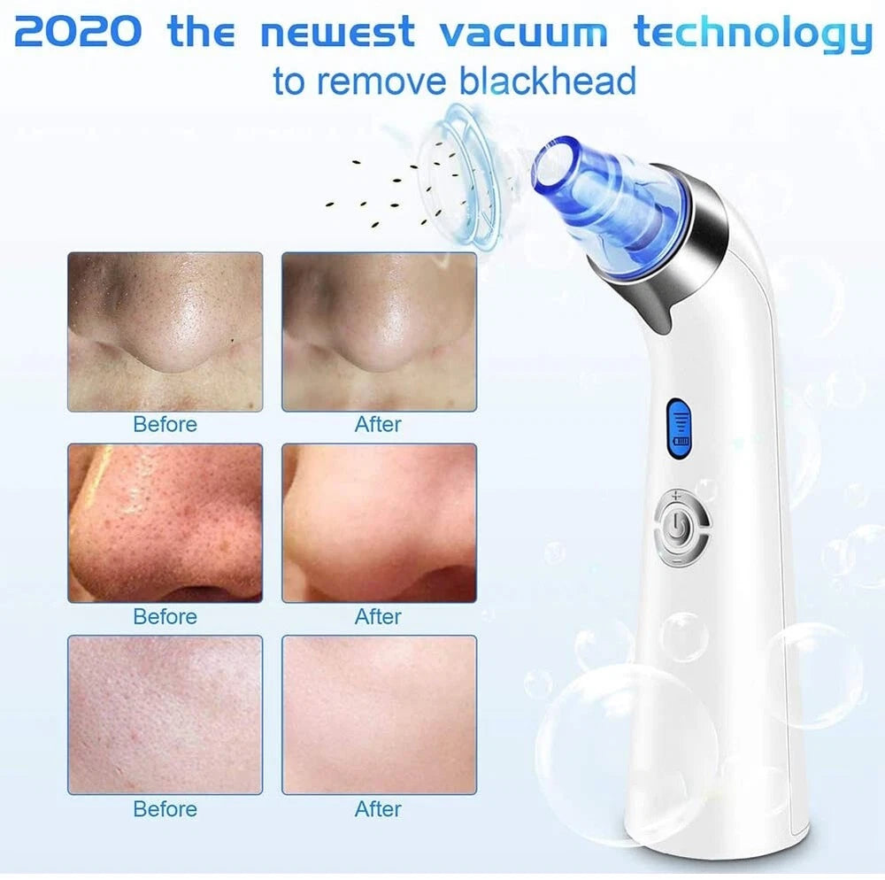 Senelux Blackhead Remover Vacuum Pore Cleaner Acne Comedone Extractor Face Pore