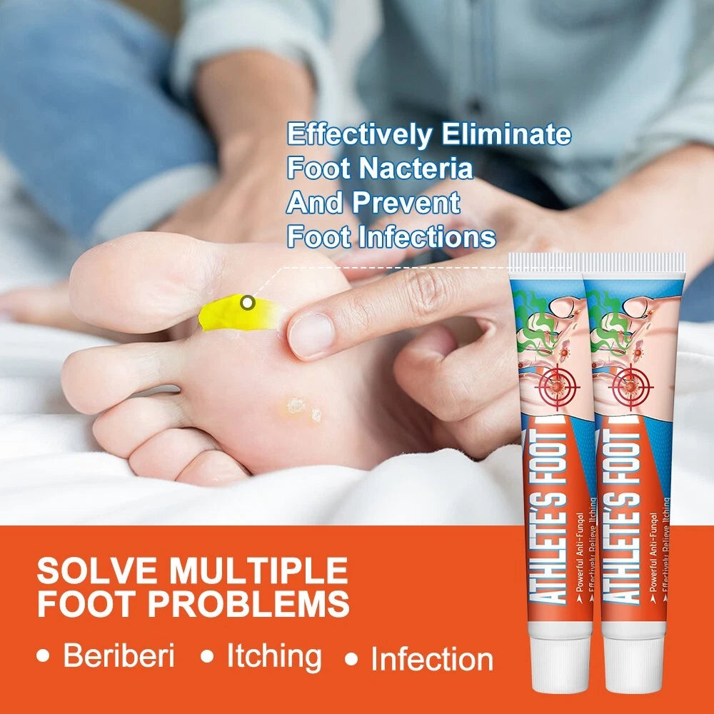Beriberi Treat Athlete's Feet Ointment Foot Itching Anti-Fungal Peeling Tinea