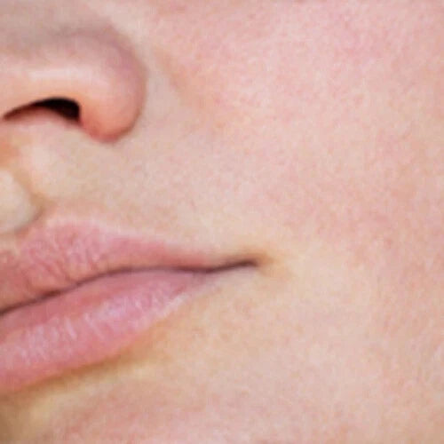 Salicylic Acid Spot Treatment for Blackheads & Blemishes, Paraben-Free VDJU  UK