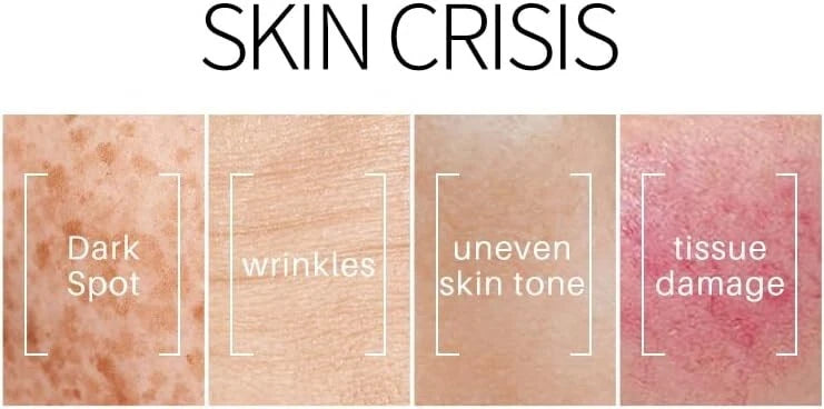 Dark Spot Remover for Face Age / Liver Spots Corrector Freckles & Skin Whitening