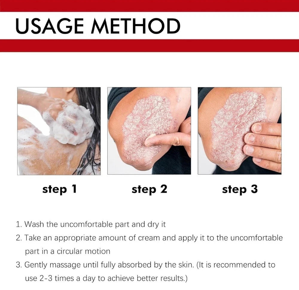 3pcs Antifungal Cream,Cream for Itchy Skin,Antifungal Cream for Skin,Itchy Skin