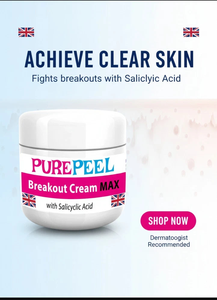 SALICYLIC ACID Cream MAX Strength 50ml For Acne Blackheads Dark Spots  Treatment