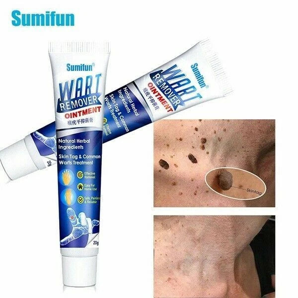 Sumifun Wart Removal Body Warts Treatment Cream Foot Care Cream Skin Tag Remover